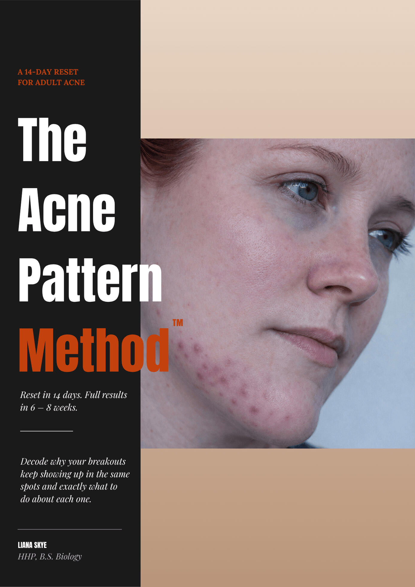 The Acne Pattern Method ebook cover a 47-page 14-day reset for adult women with persistent acne, identifying the 5 acne zones and root causes by Liana Skye, HHP, B.S. Biology